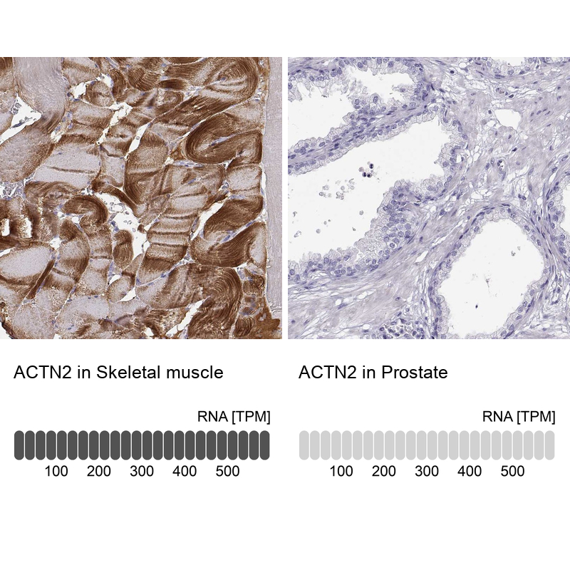 Anti-ACTN2 Antibody