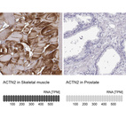 Anti-ACTN2 Antibody