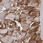 Immunohistochemical staining of human skeletal muscle shows high expression.