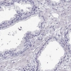 Immunohistochemical staining of human prostate shows low expression as expected.