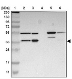Lane 1: Marker [kDa] 230, 130, 95, 72, 56, 36, 28, 17, 11_br/_Lane 2: Human cell line RT-4_br/_Lane 3: Human cell line U-251MG sp_br/_Lane 4: Human plasma (IgG/HSA depleted)_br/_Lane 5: Human liver tissue_br/_Lane 6: Human tonsil tissue