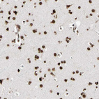 Immunohistochemical staining of human cerebral cortex shows strong nuclear positivity in neuronal cells.