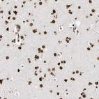 Immunohistochemical staining of human cerebral cortex shows strong nuclear positivity in neuronal cells.