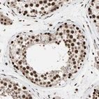 Immunohistochemical staining of human testis shows strong nuclear positivity in cells in seminiferous ducts.