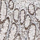 Immunohistochemical staining of human colon shows strong nuclear positivity in glandular cells.