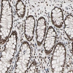 Immunohistochemical staining of human colon shows strong nuclear positivity in glandular cells.