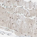 Immunohistochemical staining of human skeletal muscle shows strong nuclear positivity in myocytes.