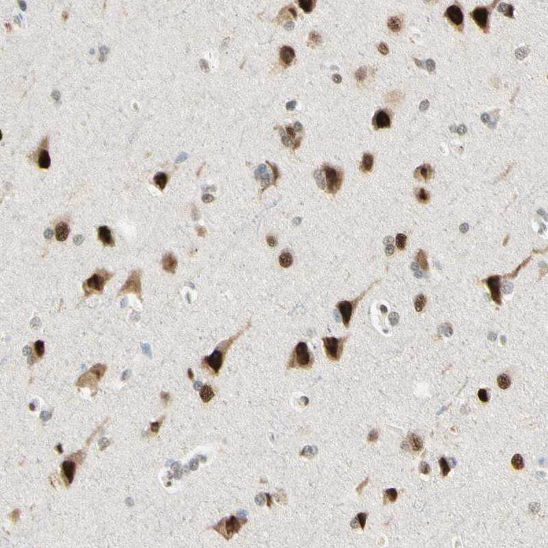 Anti-ATXN1 Antibody