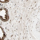 Immunohistochemical staining of human prostate shows weak to moderate nuclear positivity in smooth muscle cells.