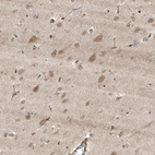 Anti-HMGCR Antibody