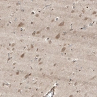 Immunohistochemical staining of human cerebral cortex shows moderate granular cytoplasmic positivity in neurons.