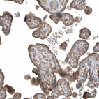 Immunohistochemical staining of human placenta shows moderate granular cytoplasmic positivity in trophoblastic cells.