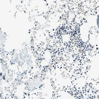 Immunohistochemical staining of human bone marrow shows low positivity in hematopoietic cells as expected.