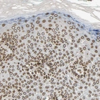 Immunohistochemical staining of human skin shows strong positivity in nuclear membrane in squamous epithelial cells.