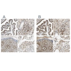 Immunohistochemical staining of human fallopian tube, kidney, skin and testis using Anti-SUN1 antibody HPA008346 (A) shows similar protein distribution across tissues to independent antibody HPA008461 (B).