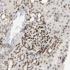 Immunohistochemical staining of human kidney shows strong positivity in nuclear membrane in cells in glomeruli.