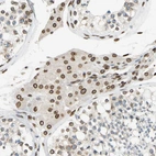 Immunohistochemical staining of human testis shows strong positivity in nuclear membrane in Leydig cells.