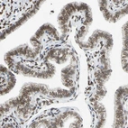 Immunohistochemical staining of human Fallopian tube shows moderate positivity in nuclear membrane in glandular cells.