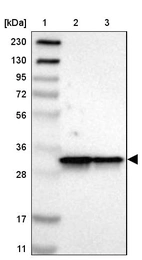 Lane 1: Marker [kDa] 230, 130, 95, 72, 56, 36, 28, 17, 11_br/_Lane 2: Human cell line RT-4_br/_Lane 3: Human cell line U-251MG sp