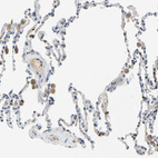 Immunohistochemical staining of human lung shows moderate cytoplasmic positivity in macrophages.