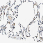 Immunohistochemical staining of human lung shows moderate cytoplasmic positivity in macrophages.