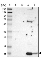 Lane 1: Marker [kDa] 230, 130, 95, 72, 56, 36, 28, 17, 11_br/_Lane 2: Human cell line RT-4_br/_Lane 3: Human cell line U-251MG sp_br/_Lane 4: Human plasma (IgG/HSA depleted)_br/_Lane 5: Human liver tissue