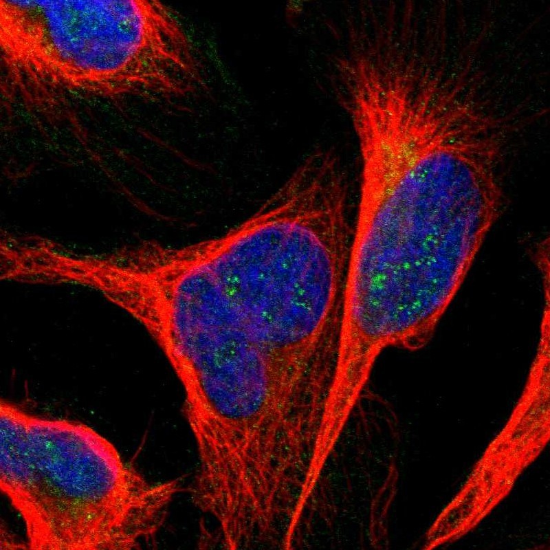 Anti-ANKS6 Antibody