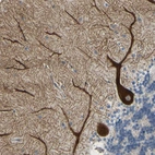 Immunohistochemical staining of human cerebellum shows strong membranous positivity in Purkinje cells.