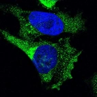 Immunofluorescent staining of human cell line U-251 MG shows localization to cytosol & vesicles.