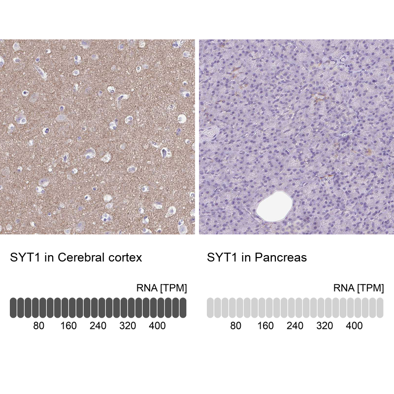 Anti-SYT1 Antibody