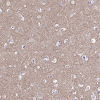 Immunohistochemical staining of human cerebral cortex shows moderate cytoplasmic positivity in neuropil.