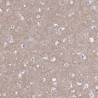 Immunohistochemical staining of human cerebral cortex shows moderate cytoplasmic positivity in neuropil.