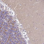 Immunohistochemical staining of human cerebellum shows moderate cytoplasmic positivity in neuropil.