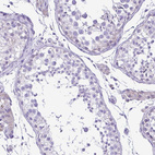 Anti-SYT1 Antibody