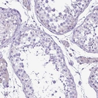 Immunohistochemical staining of human testis shows no positivity in cells in seminiferous ducts as expected.