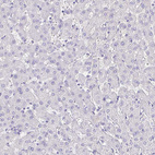 Anti-SYT1 Antibody