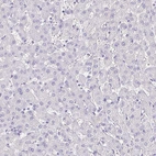 Immunohistochemical staining of human liver shows no positivity in hepatocytes as expected.