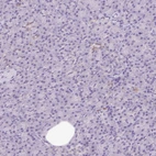 Immunohistochemical staining of human pancreas shows no positivity as expected.