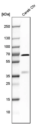 Western blot analysis in human cerebral cortex tissue.