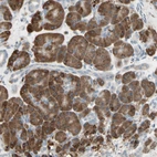 Anti-NUCB2 Antibody