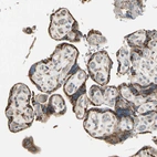 Immunohistochemical staining of human placenta shows strong cytoplasmic positivity in trophoblastic cells.