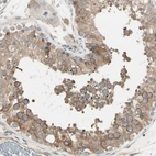 Immunohistochemical staining of human testis shows moderate cytoplasmic positivity in cells in seminiferous ducts.