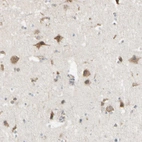 Immunohistochemical staining of human cerebral cortex shows moderate cytoplasmic positivity in neurons.