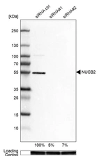 Western blot analysis in U-87MG ATCC cells transfected with control siRNA, target specific siRNA probe #1 and #2, using Anti-NUCB2 antibody. Remaining relative intensity is presented. Loading control: Anti-GAPDH.