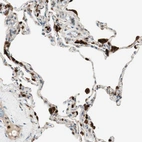Anti-LTA4H Antibody