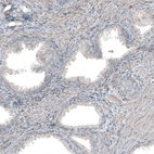 Immunohistochemical staining of human prostate shows weak cytoplasmic positivity in smooth muscle cells.