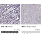 Anti-QPCT Antibody
