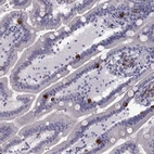 Immunohistochemical staining of human duodenum shows strong cytoplasmic positivity in enteroendocrine cells.