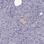 Immunohistochemical staining of human pancreas shows weak cytoplasmic positivity in islets of Langerhans.
