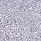 Immunohistochemical staining of human liver shows no positivity in hepatocytes as expected.